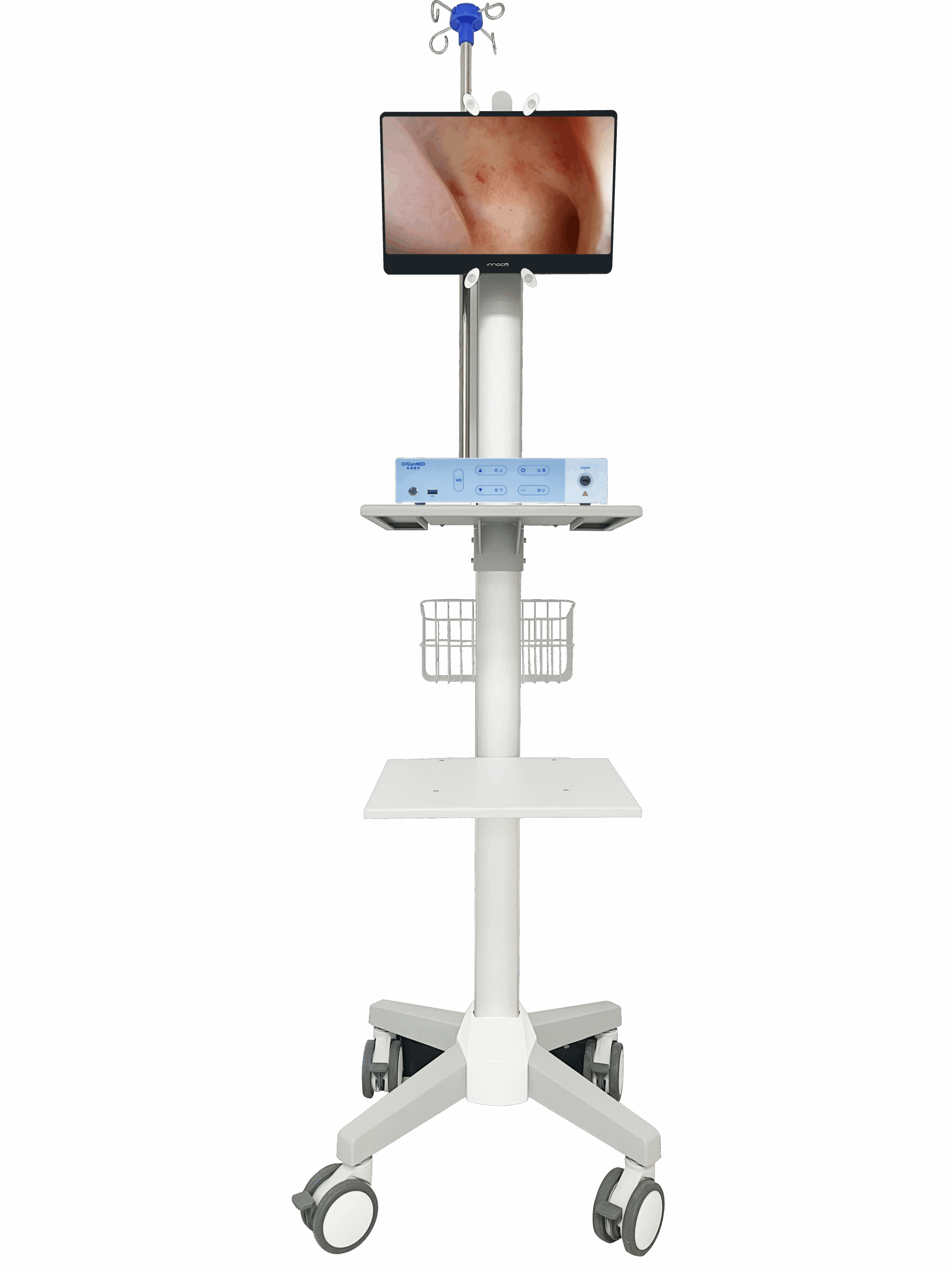 tower in trolley clearvision